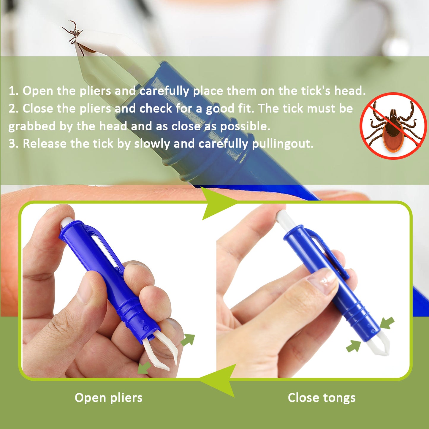 3-Piece Tick Remover Tool Set – Safe & Painless for Dogs, Cats & Humans